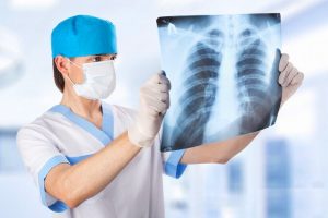 Пневмония: признаки и лечение воспаления легких